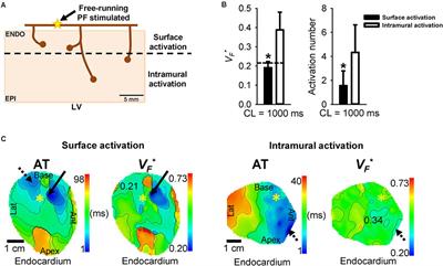 Role of the Purkinje-Muscle Junction on the Ventricular Repolarization Heterogeneity in the Healthy and Ischemic Ovine Ventricular Myocardium